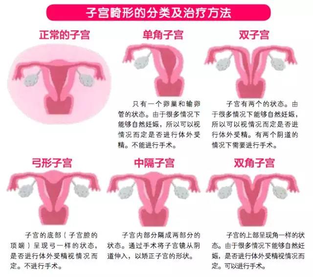 试管子宫问题