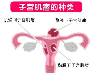 试管子宫问题