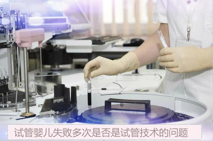 试管婴儿失败多次是否是试管技术的问题
