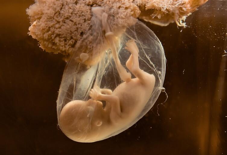 建议胎停育别等自然流产-残留物会影响下次的生育
