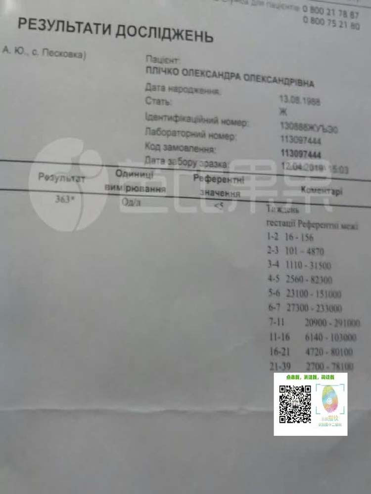 X姐做乌克兰试管验孕成功 担心别人异样的眼光亚裔女孩试管