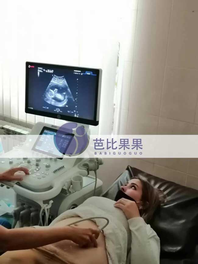 乌克兰代妈做产检B超