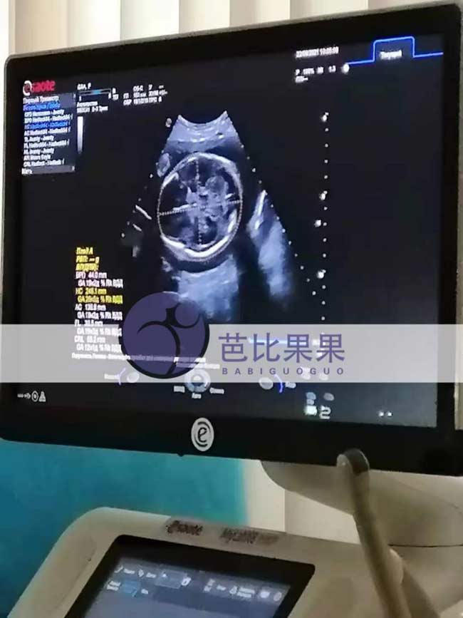 乌克兰孕妈做产检
