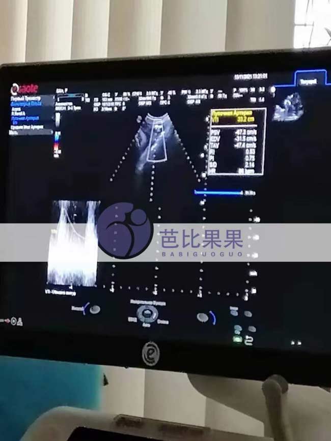 乌克兰试管孕妈做B超