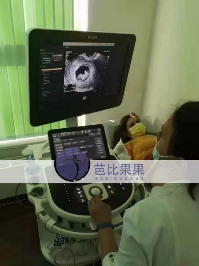 乌克兰孕妈第二次B超