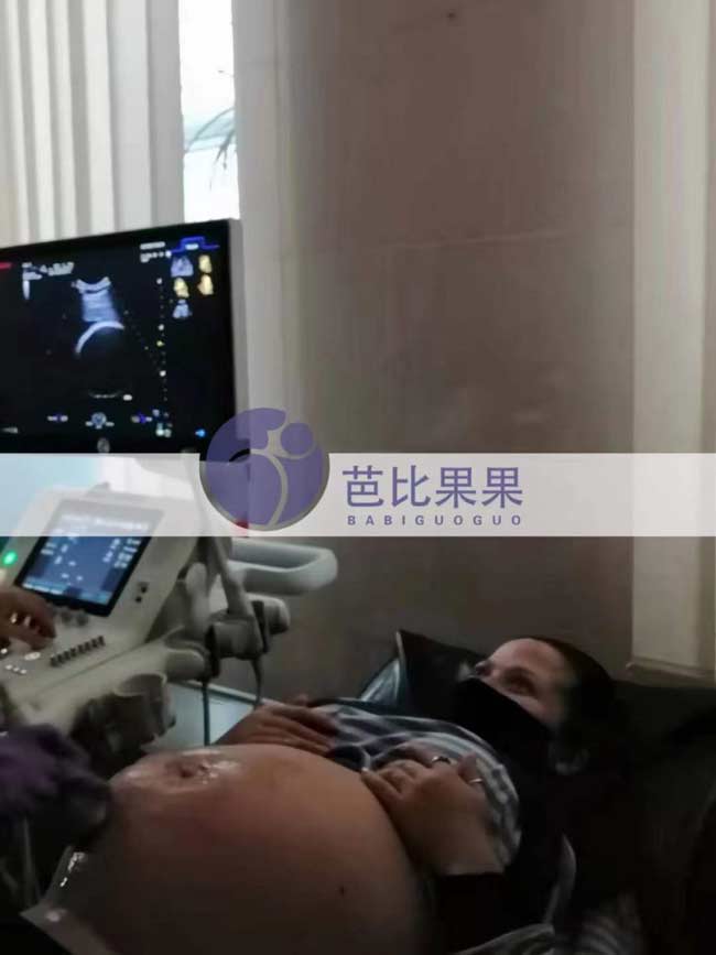 乌克兰试管孕做B超