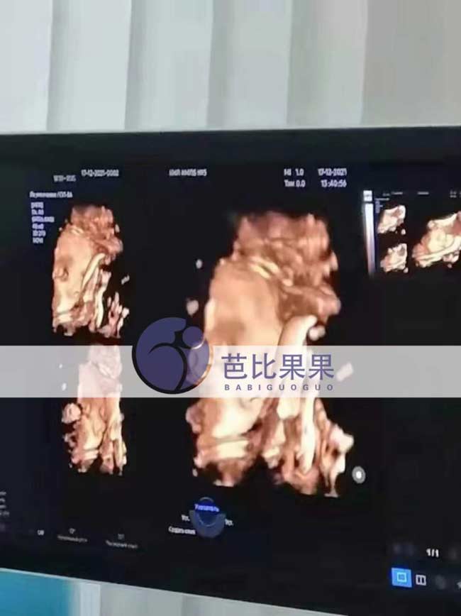 乌克兰孕妈产检