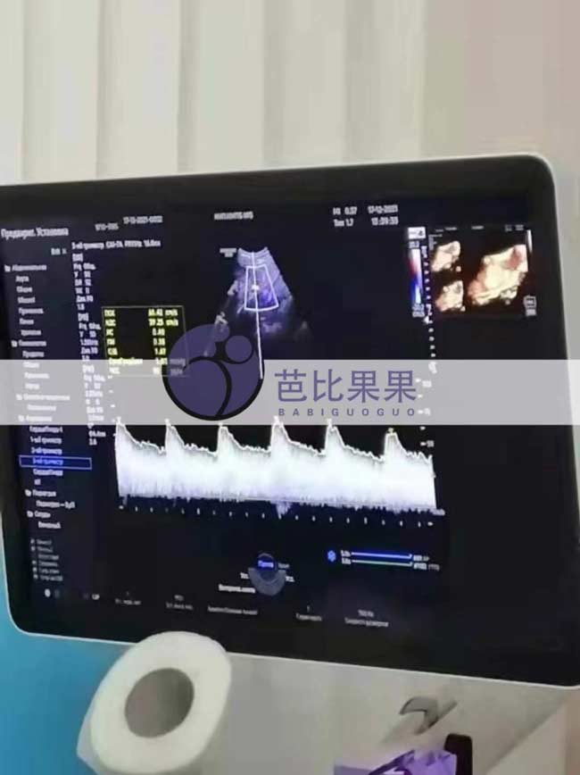 乌克兰孕妈产检