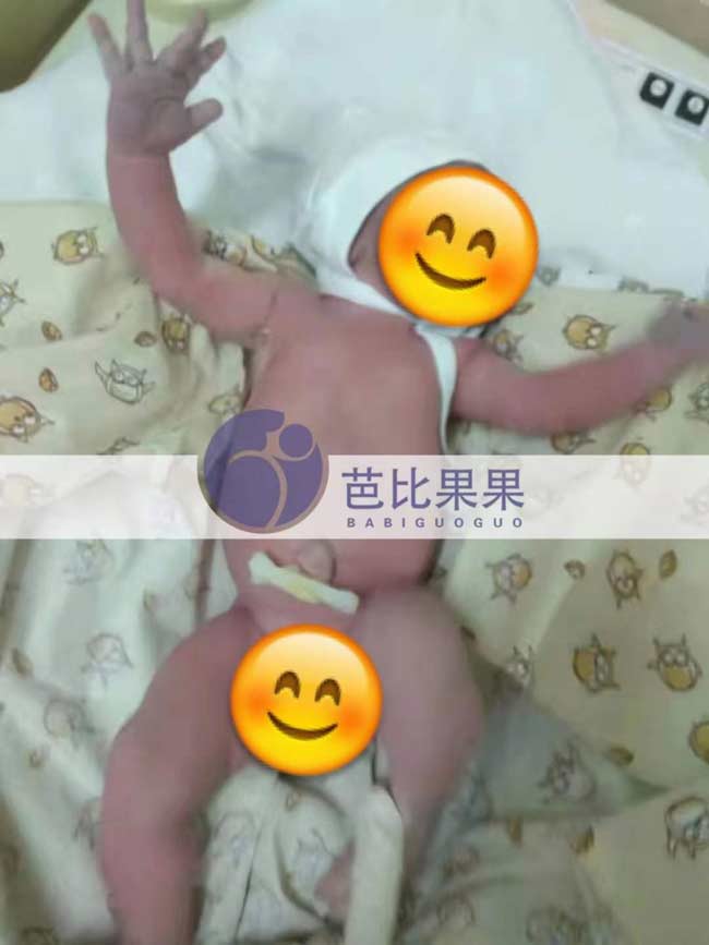 乌克兰试管宝宝出生
