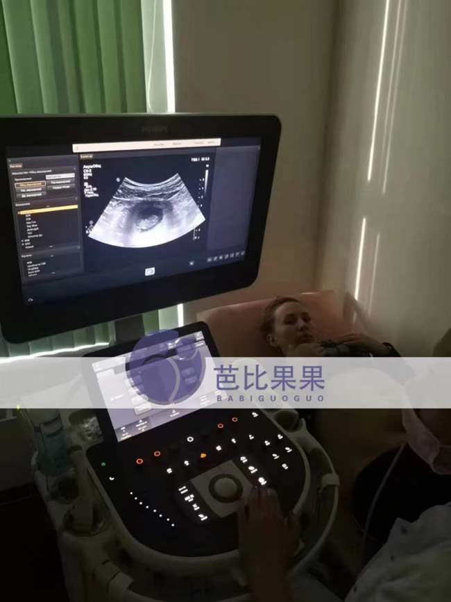 乌克兰试管孕妈做B超