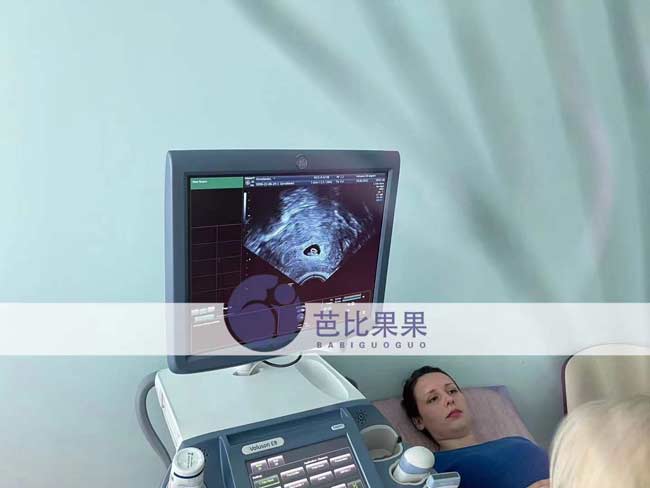乌克兰试管妈妈做B超