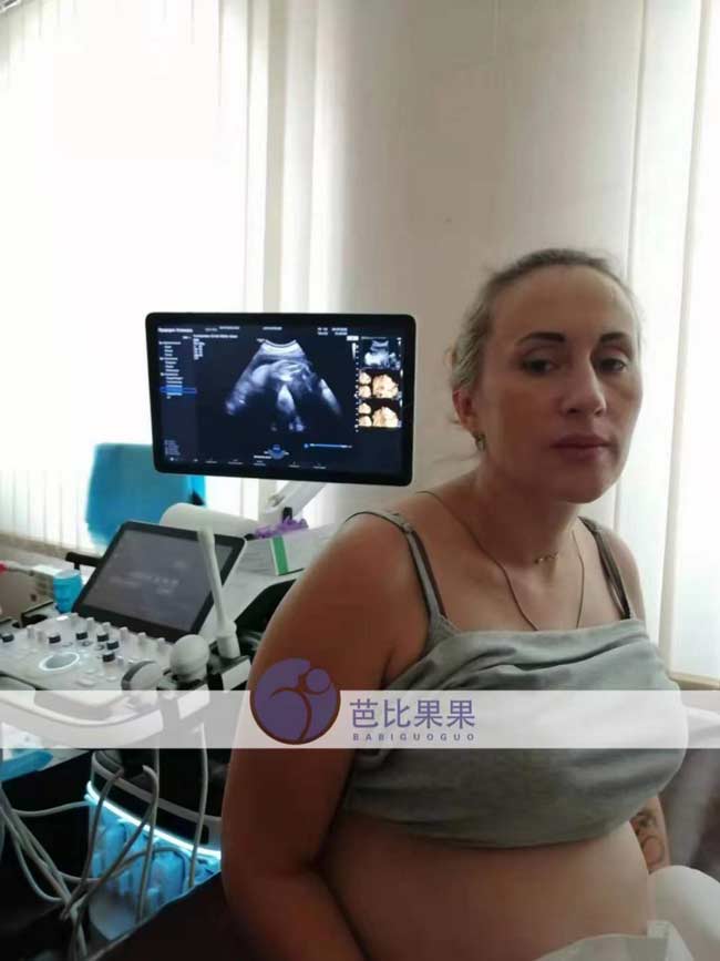 乌克兰试管妈妈做四维彩超