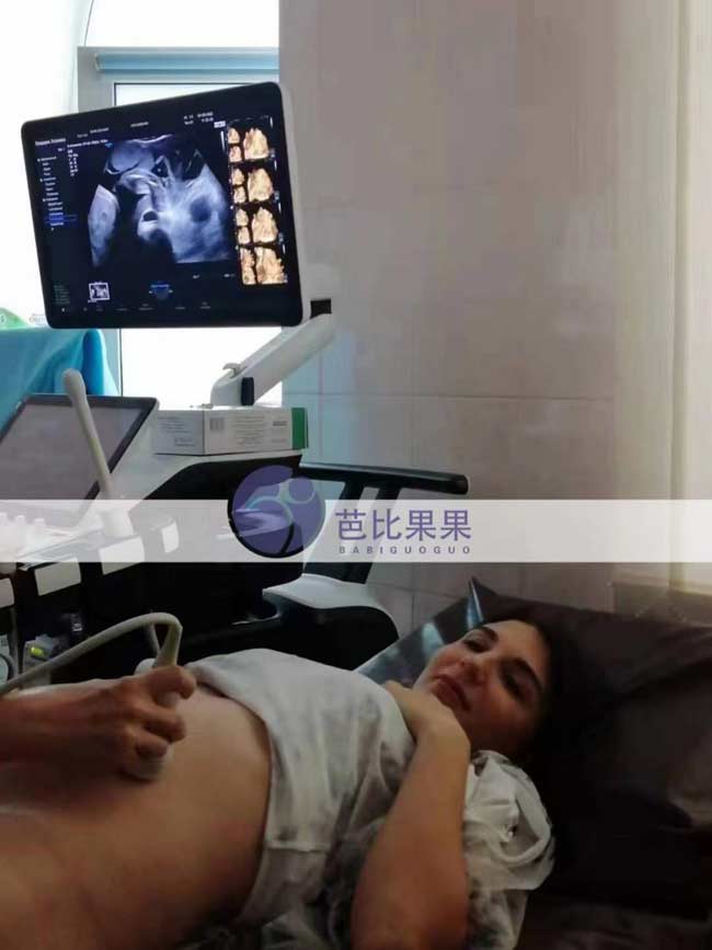 乌克兰试管妈妈四维彩超