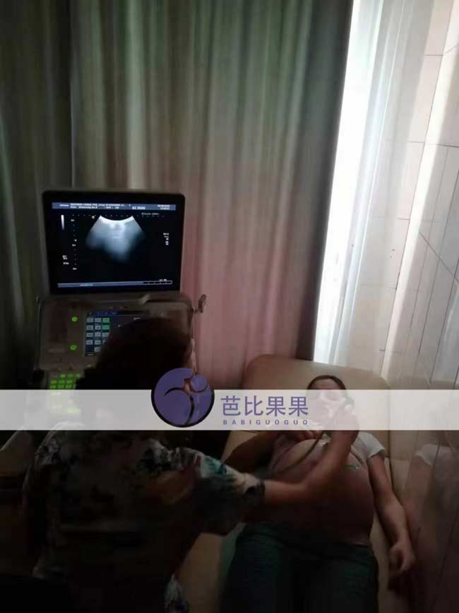 乌克兰试管B超检查