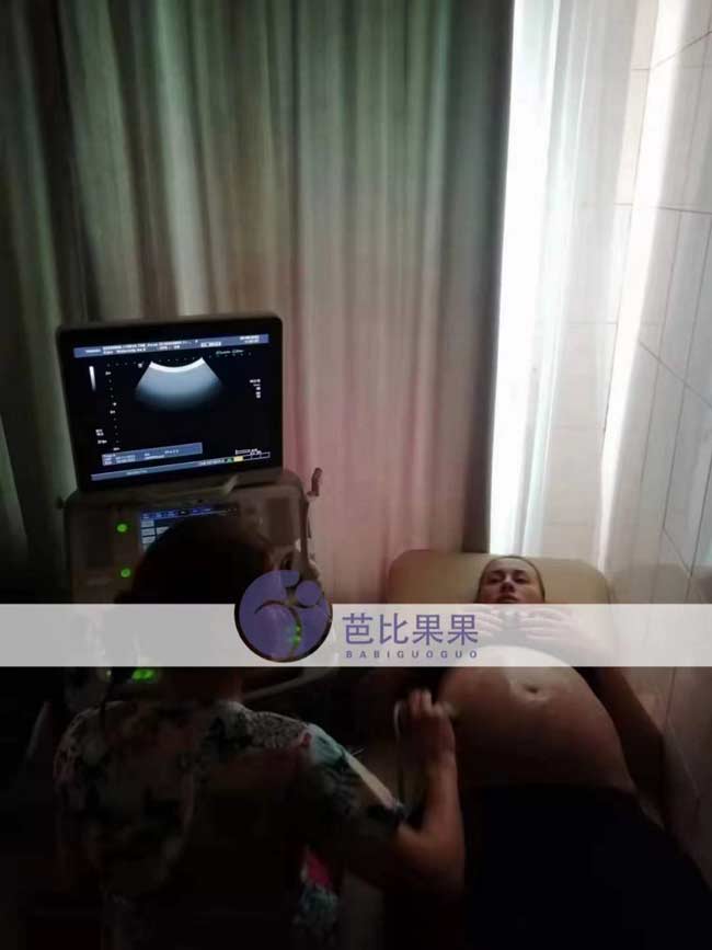 乌克兰试管B超检查