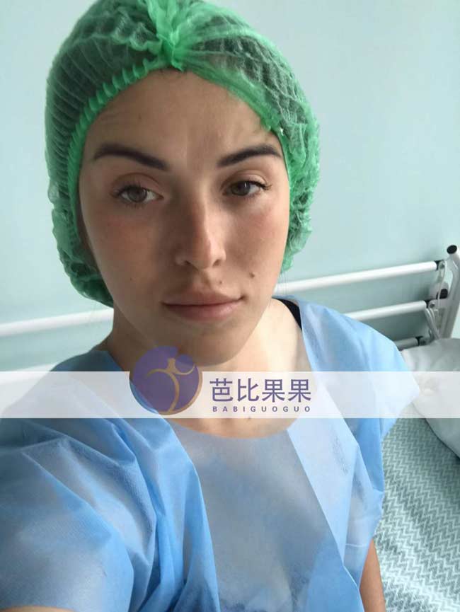 西安C先生家的乌克兰试管妈妈来LITA丽塔医院移植胚胎