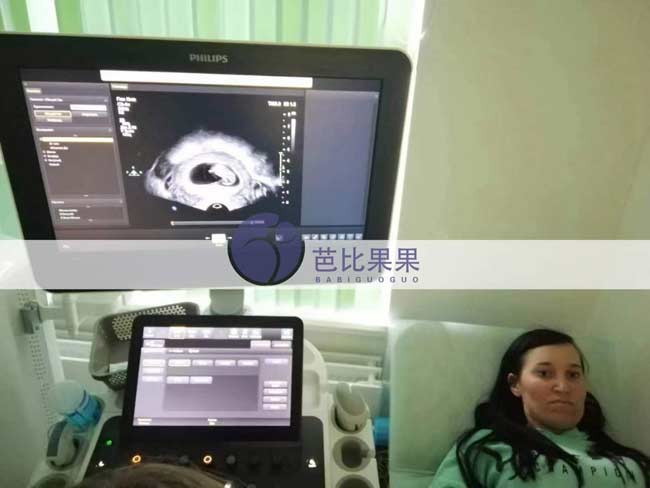L先生夫妻的乌克兰试管妈妈来做B超，胎宝宝发育的很好