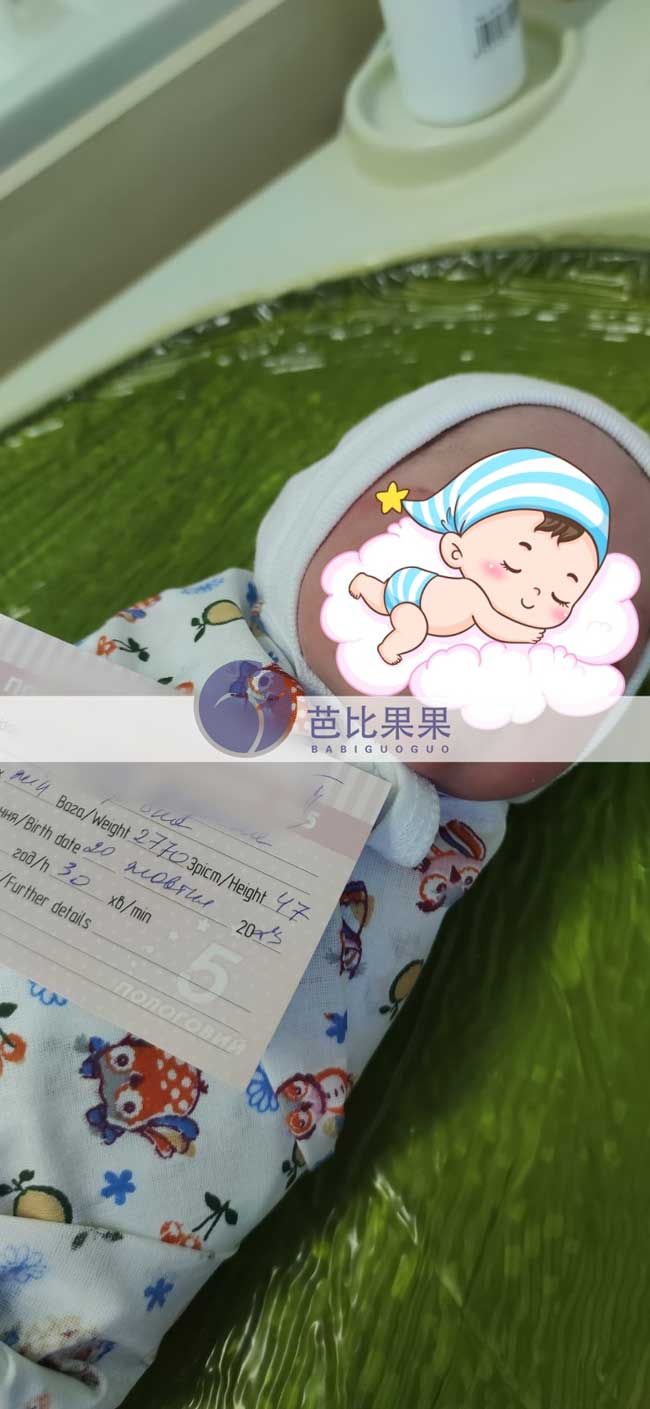 Z女士夫妻家的乌克兰试管龙凤胎宝宝顺产出生
