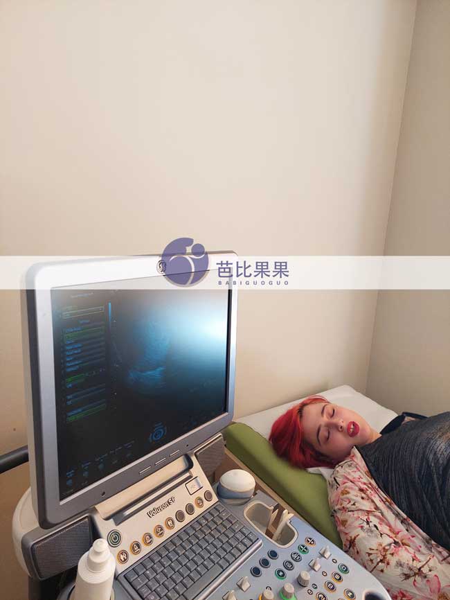 Y女士家的格鲁吉亚试管妈妈来做第一次B超产检