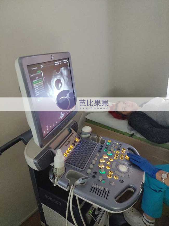 格鲁吉亚试管妈妈首次B超
