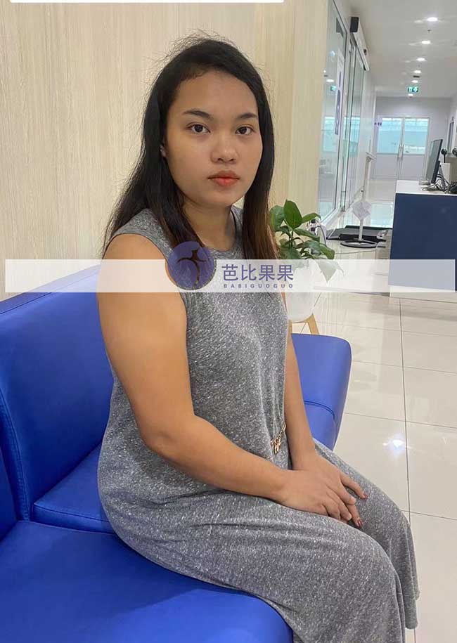 泰国试管妈妈孕18周B超