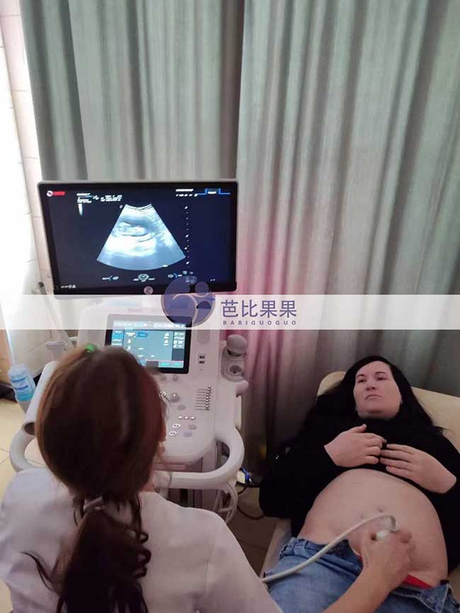 乌克兰试管妈妈孕12周B超