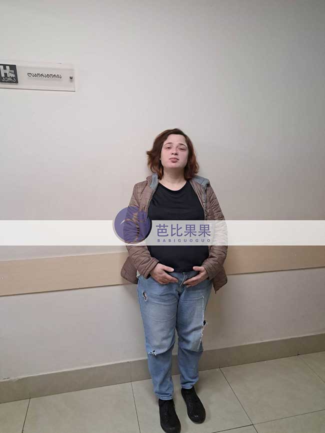 深圳Y女士在格鲁吉亚匹配的年轻试管妈妈孕22周B超检查