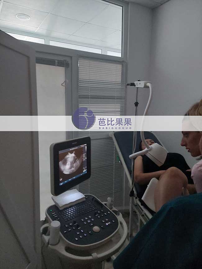 X先生在格鲁吉亚dy的试管妈妈第二次B超确认双胞胎