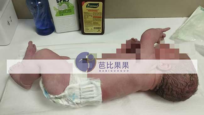 D先生夫妇选择格鲁吉亚DY的试管女宝宝顺利出生