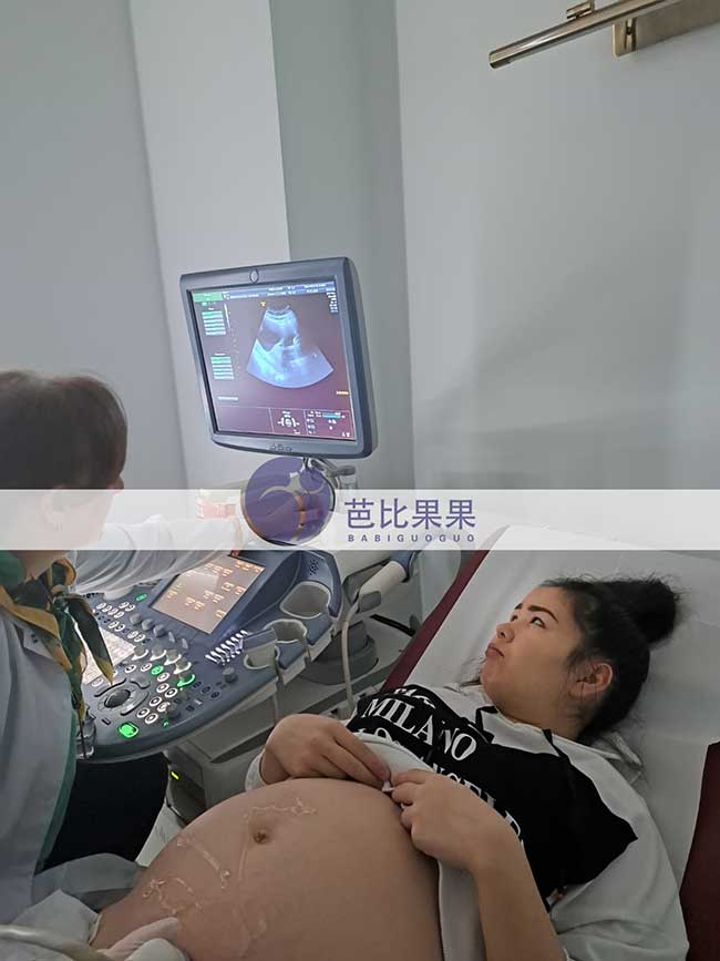 试管妈妈做四维彩超