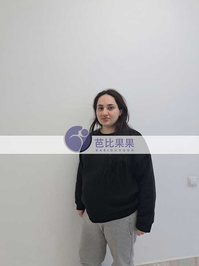 乌克兰试管妈妈四维彩超