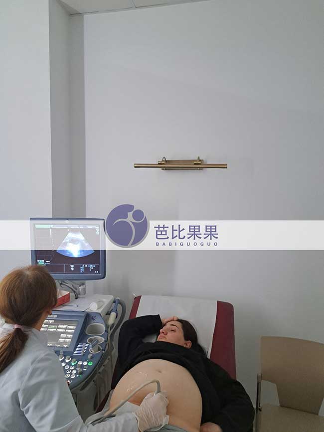 乌克兰试管妈妈四维彩超