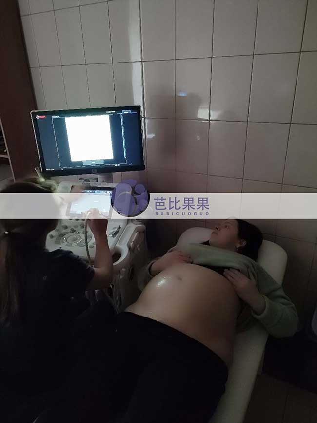 试管妈妈做B超