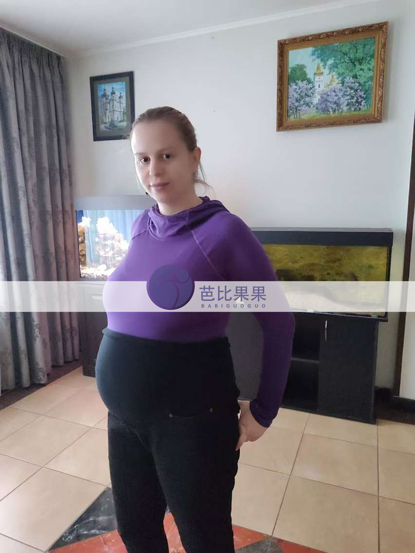 浙江G女士夫妇在格鲁吉亚助孕匹配的试管妈妈做四维彩超