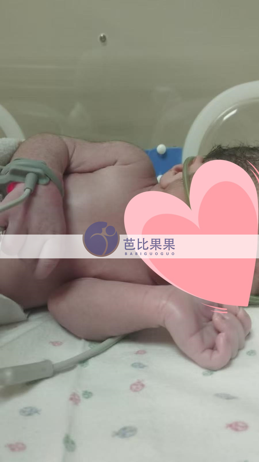格鲁吉亚试管宝宝出生
