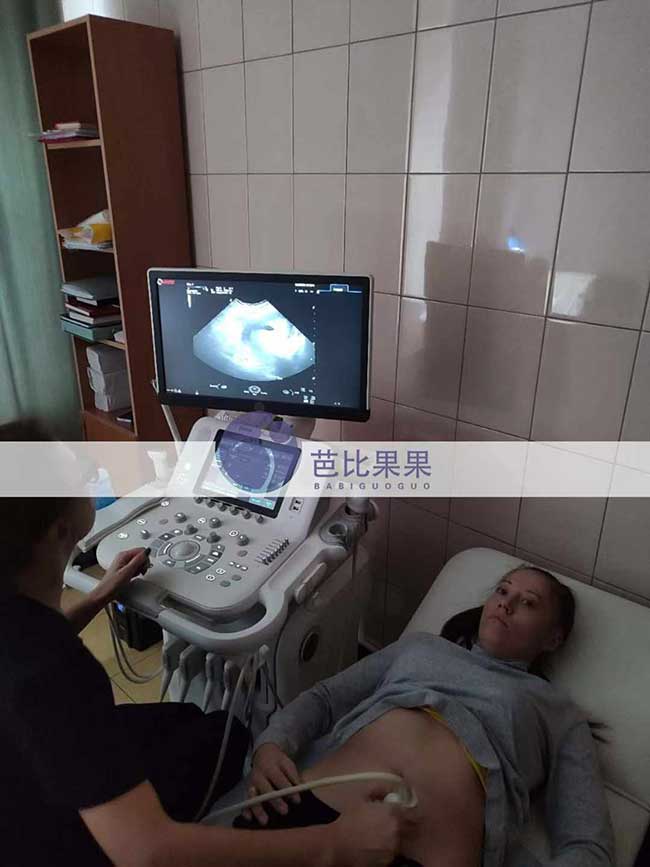 试管妈妈孕10周B超