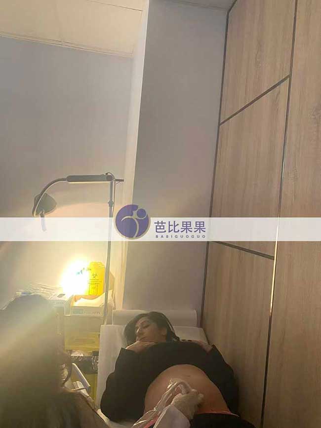 试管妈妈做B超