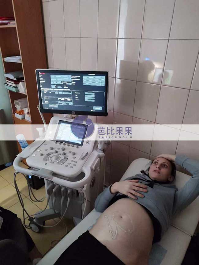 乌克兰试管妈妈做B超