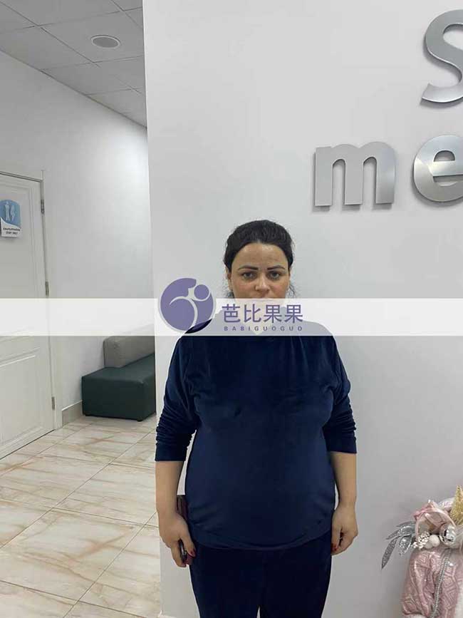 格鲁吉亚客户Z女士和L先生她们的试管妈妈分别做孕22周B超