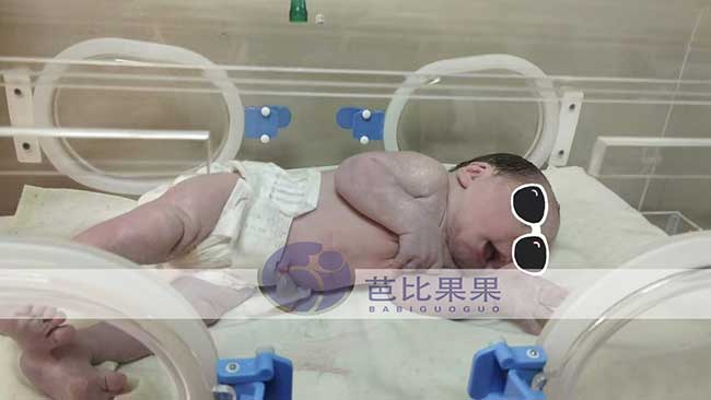香港Z先生去年到格鲁吉亚助孕的试管小王子顺产出生
