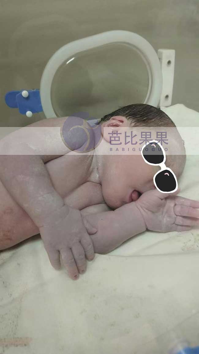 格鲁吉亚试管宝宝出生