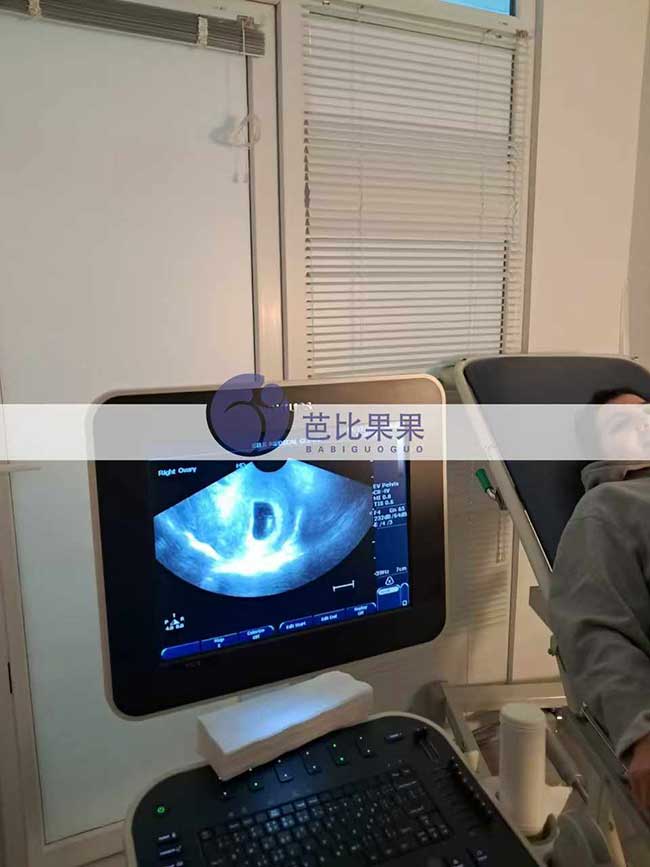 试管妈妈首次B超