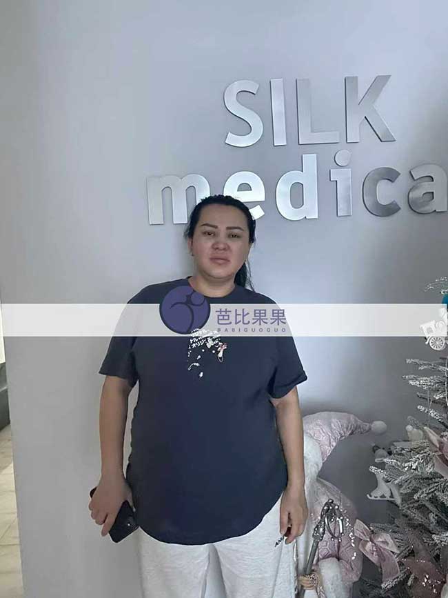 江苏两个家庭在格鲁吉亚匹配的试管妈妈来医院做B超