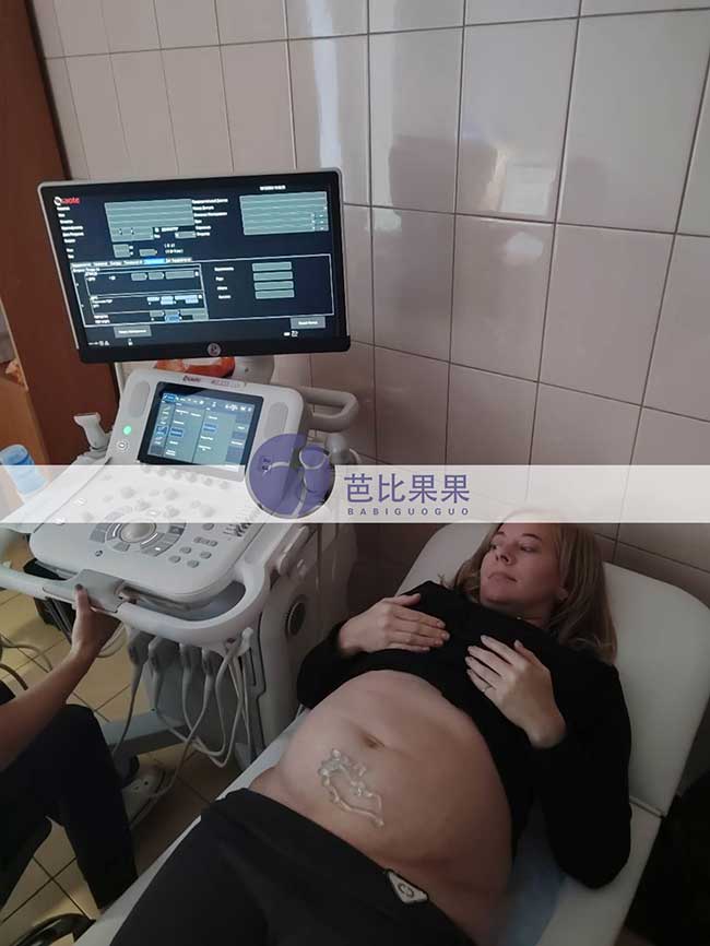 试管妈妈B超检查