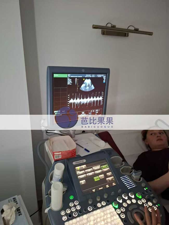 试管妈妈B超检查