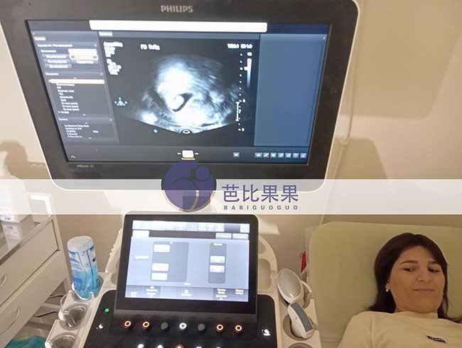上海孙先生夫妇在乌克兰试管首次B超确认着床双胞胎宝宝