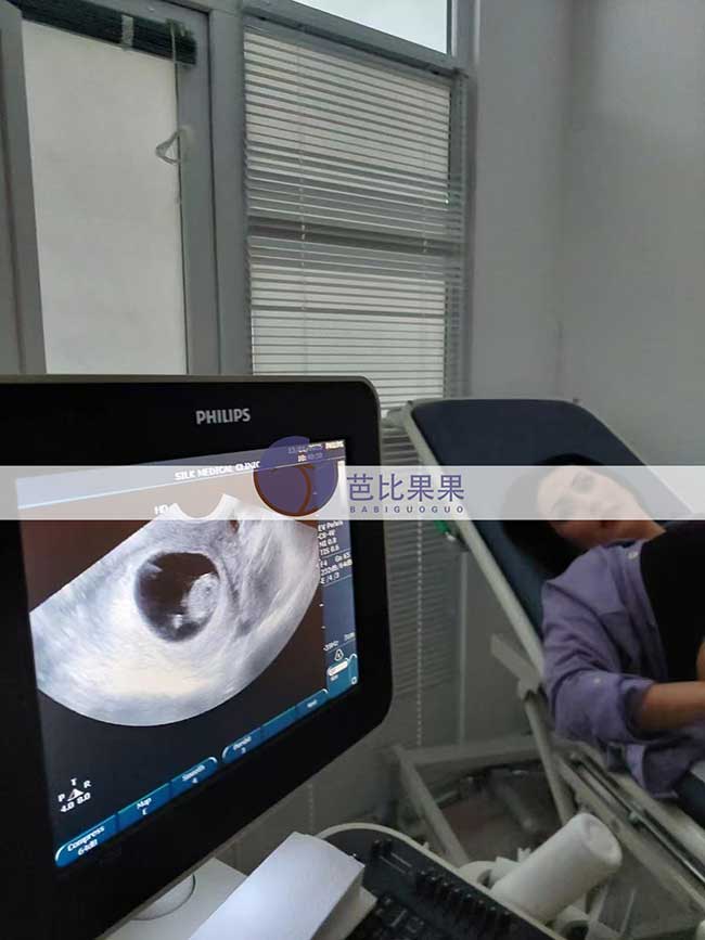 试管妈妈B超检查