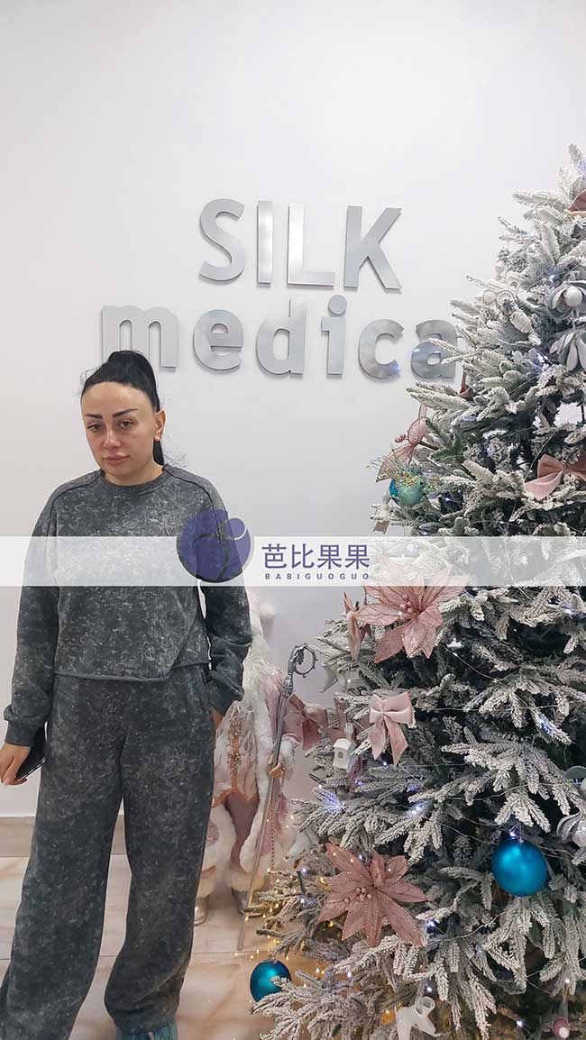 试管妈妈B超检查