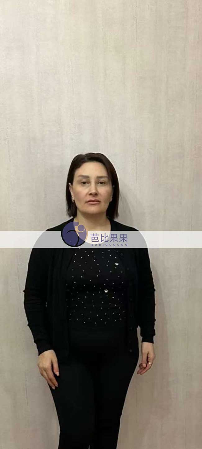 试管妈妈B超检查