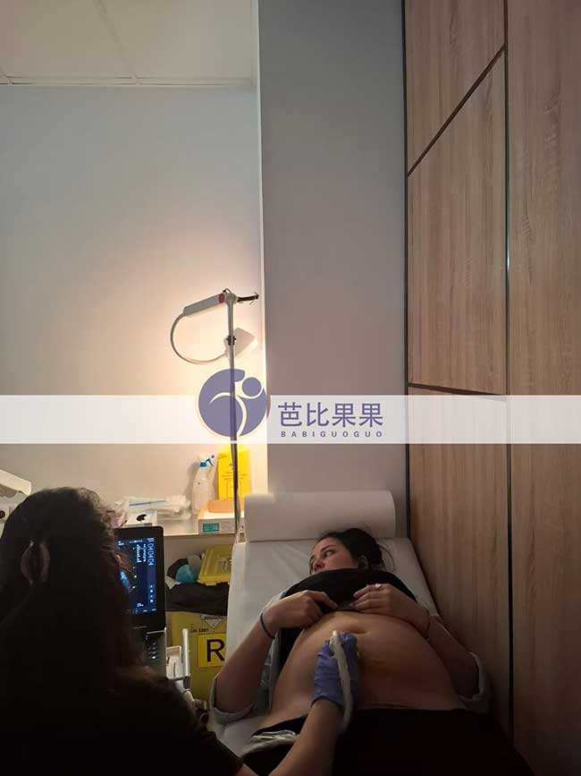 试管妈妈B超检查